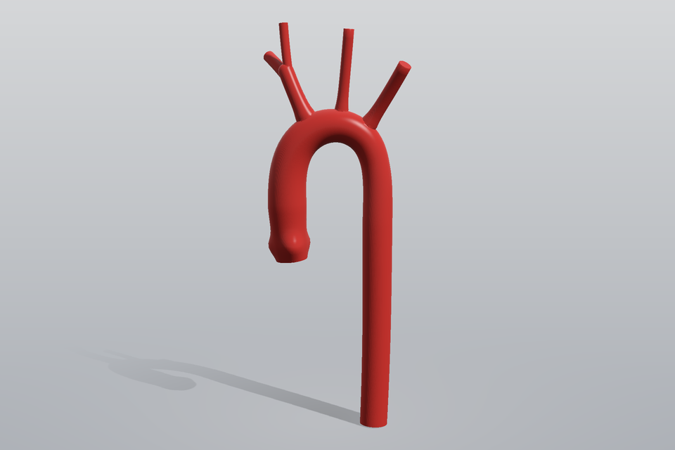 aortic_arch